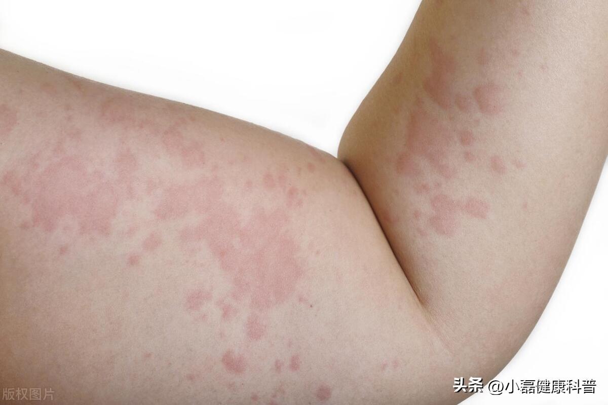 養(yǎng)生吃什么堅果好_吃堅果養(yǎng)生嗎_養(yǎng)生堅果吃好還是吃好